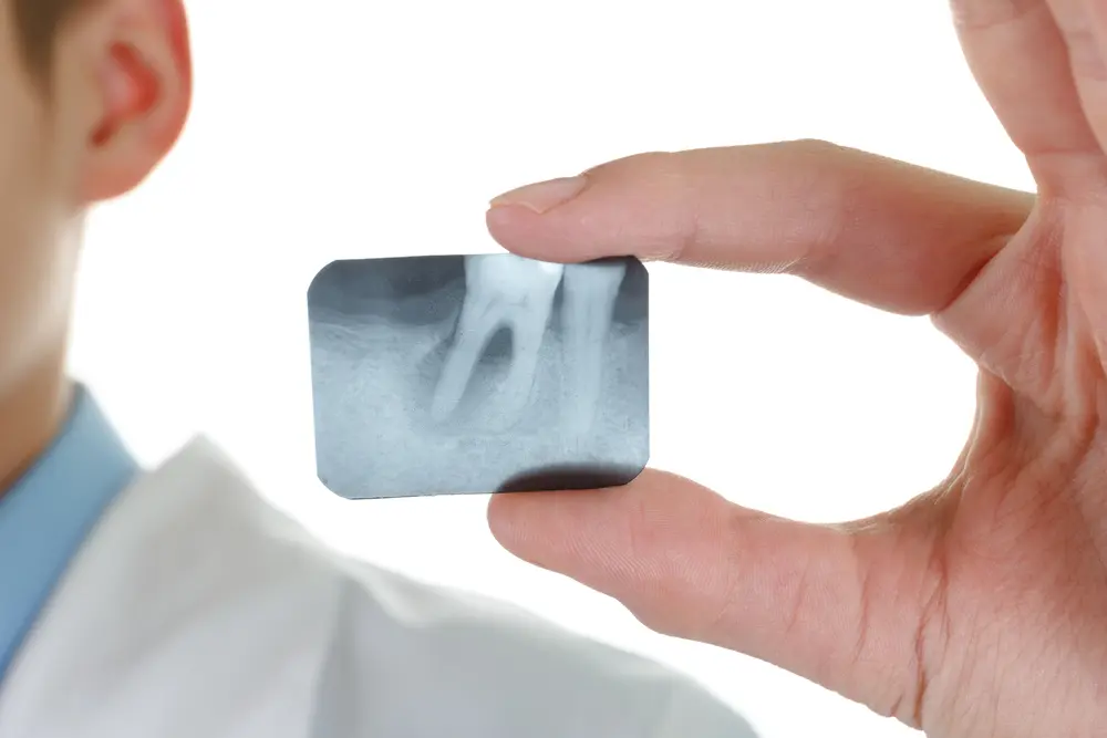 True Dental | West Kelowna Dentist | Maximize Dental Coverage, Periodontal Disease