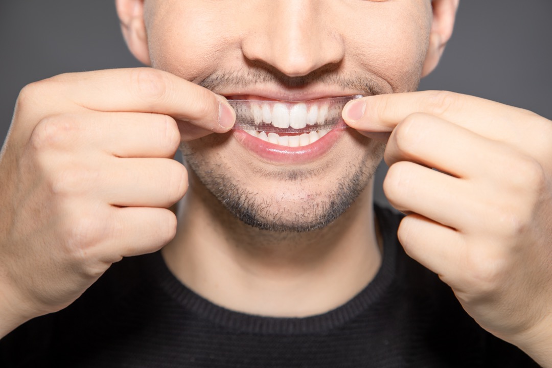 Man applying whitening strips to his teeth 