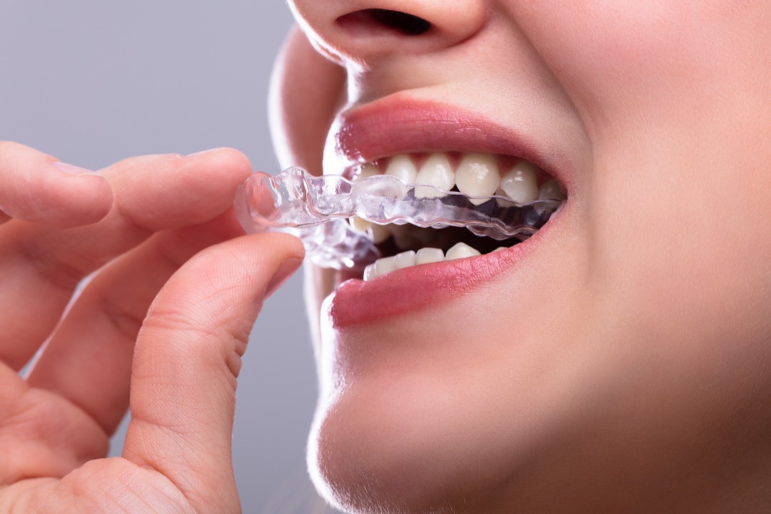 Woman using tray to whiten her teeth