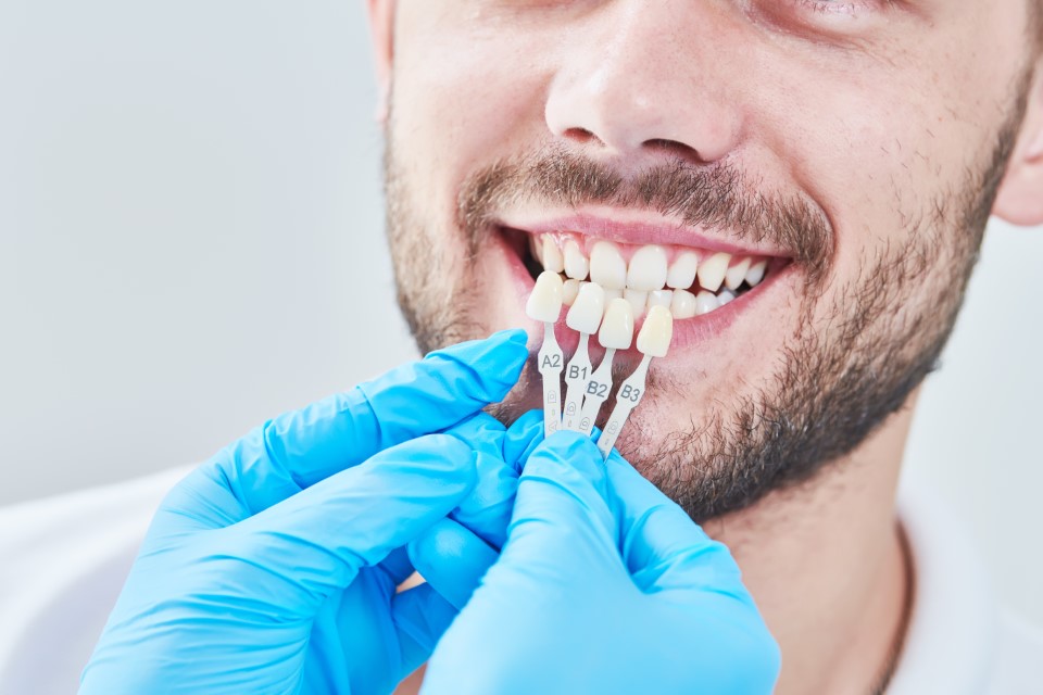 Man having teeth matched for whitening procedure