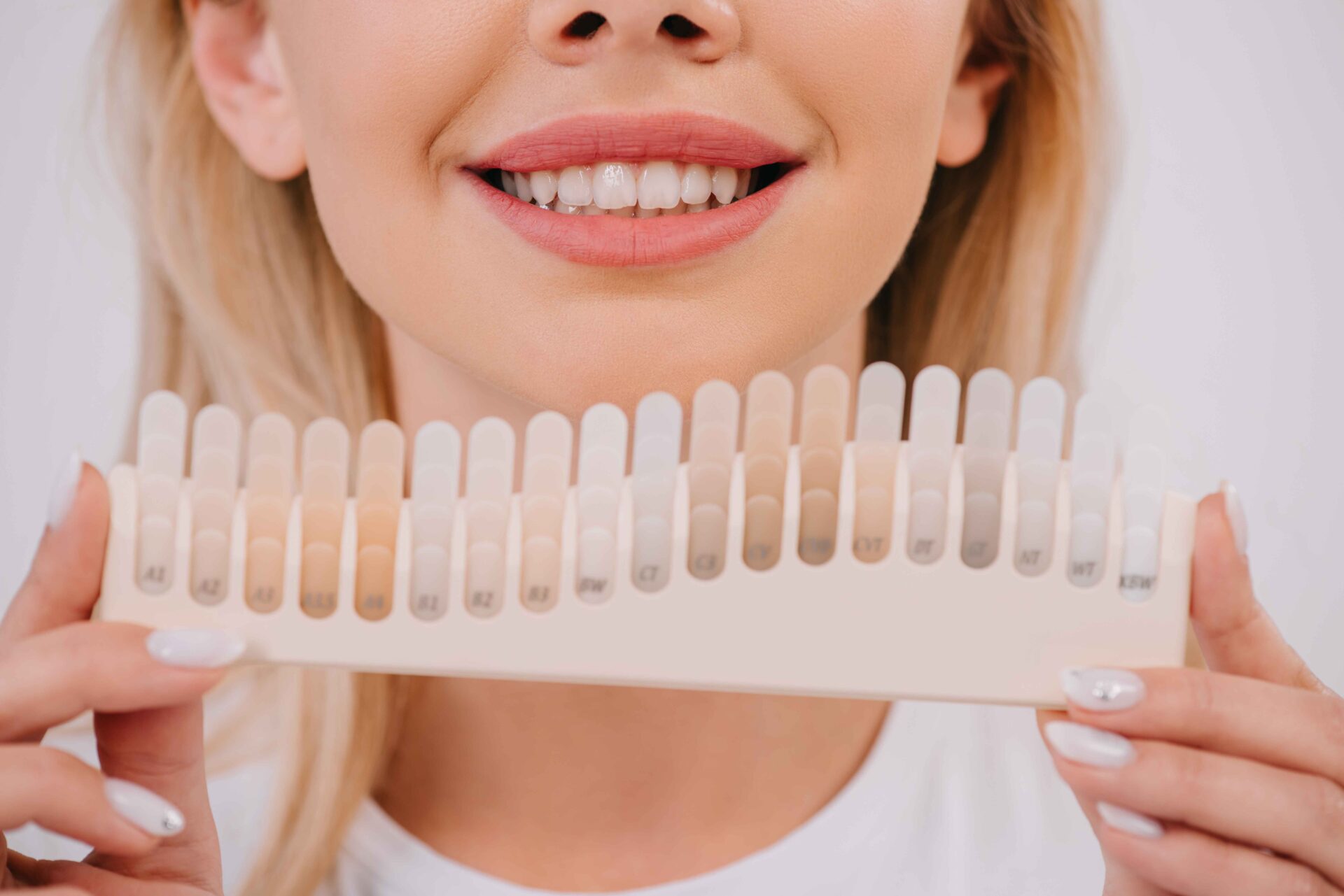 professional teeth whitening services from a west kelowna dentist