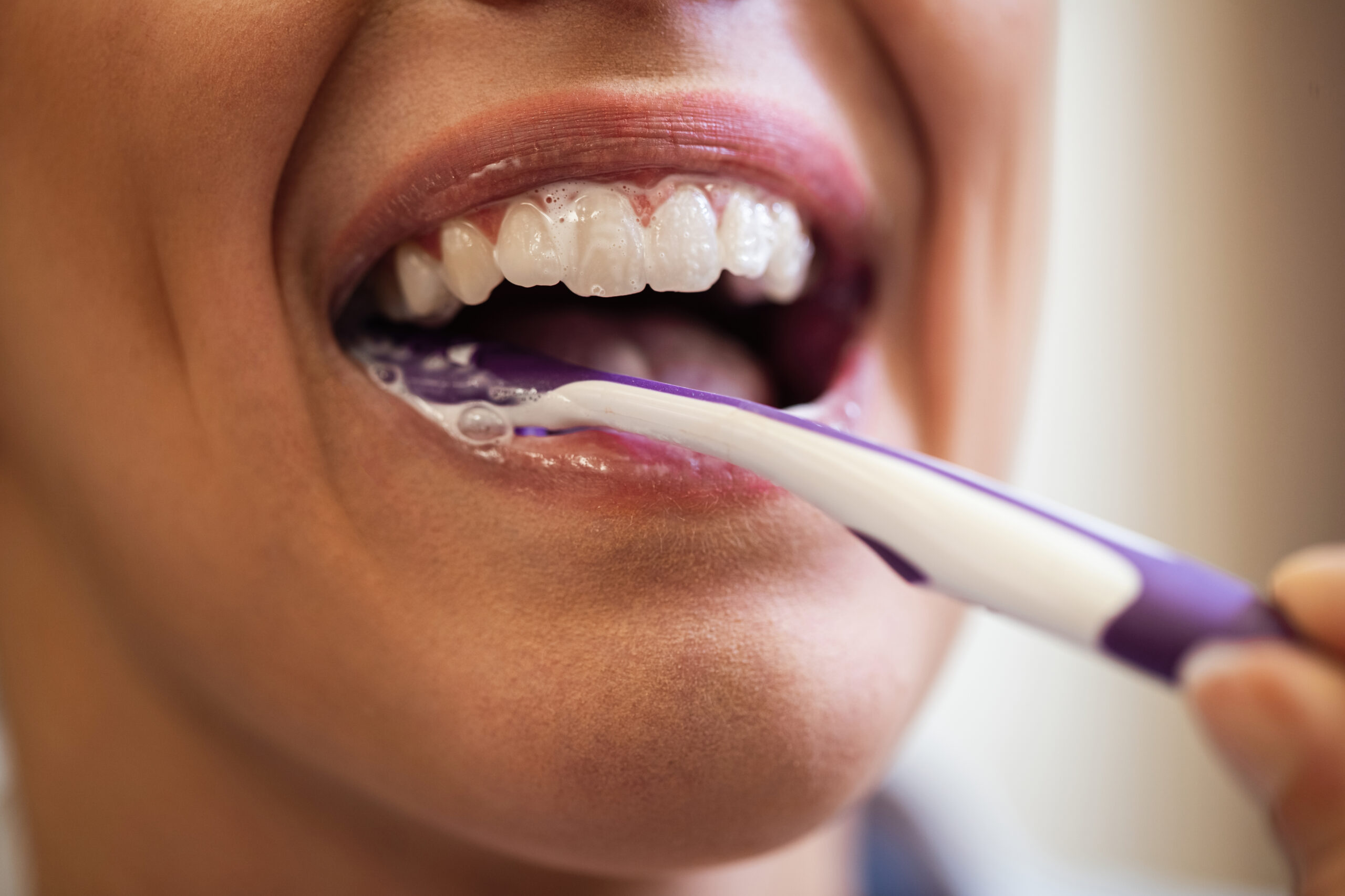 Dental decay prevention with daily brushing